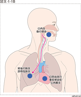 図Ⅹ-1-1B