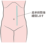 図Ⅴ-3-2